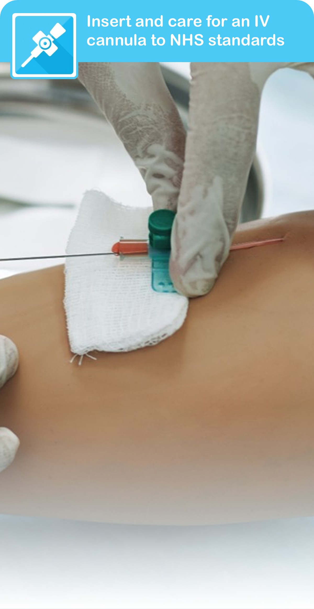 Intravenous (IV) Cannulation