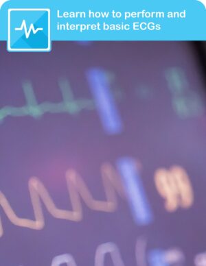 ECG